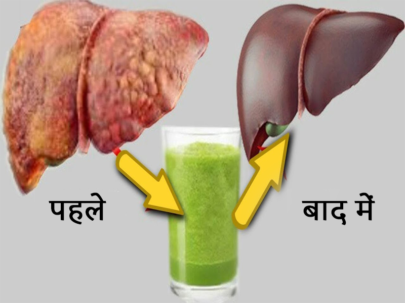 लीवर को स्वस्थ कैसे रखें